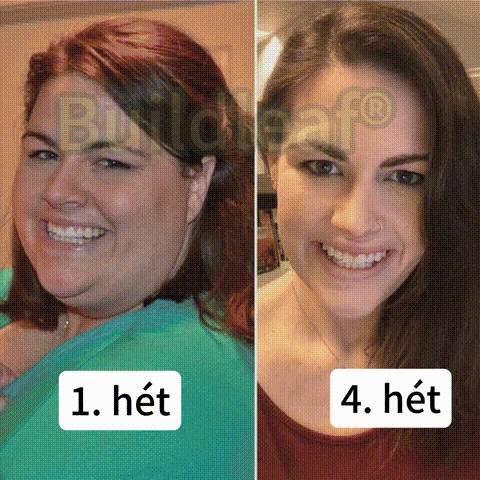 【Hivatalos áruház】🍃🍃Buildleaf® SMGT-GLP-1 Nano Mikrotű Tapasz - Kollagénnel és Matrixyl 3000-rel 丨Célzott hatás: elhízás, megereszkedett bőr, magas vérnyomás, cukorbetegség, zsírmáj, testi fájdalmak és egyéb problémák ellen