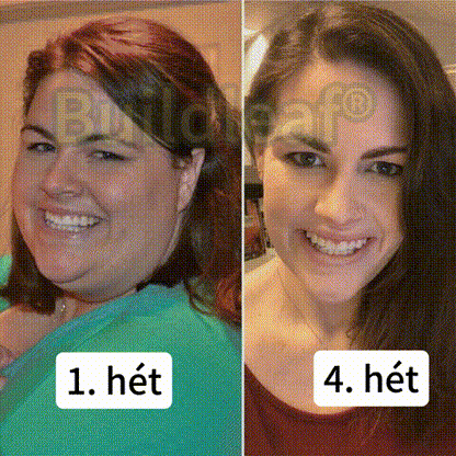 【Hivatalos áruház】🍃🍃Buildleaf® SMGT-GLP-1 Nano Mikrotű Tapasz - Kollagénnel és Matrixyl 3000-rel 丨Célzott hatás: elhízás, megereszkedett bőr, magas vérnyomás, cukorbetegség, zsírmáj, testi fájdalmak és egyéb problémák ellen