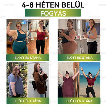 ✅│Hivatalos webáruház│🌿 CrazyLeaf® SMGT-GLP-1 Nano Mikrotűs Tapasz 👉Természetes segítség túlsúly, fáradtság, bőr- és ízületi problémák ellen.