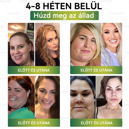 ✅│Hivatalos webáruház│🌿 CrazyLeaf® SMGT-GLP-1 Nano Mikrotűs Tapasz 👉Természetes segítség túlsúly, fáradtság, bőr- és ízületi problémák ellen.