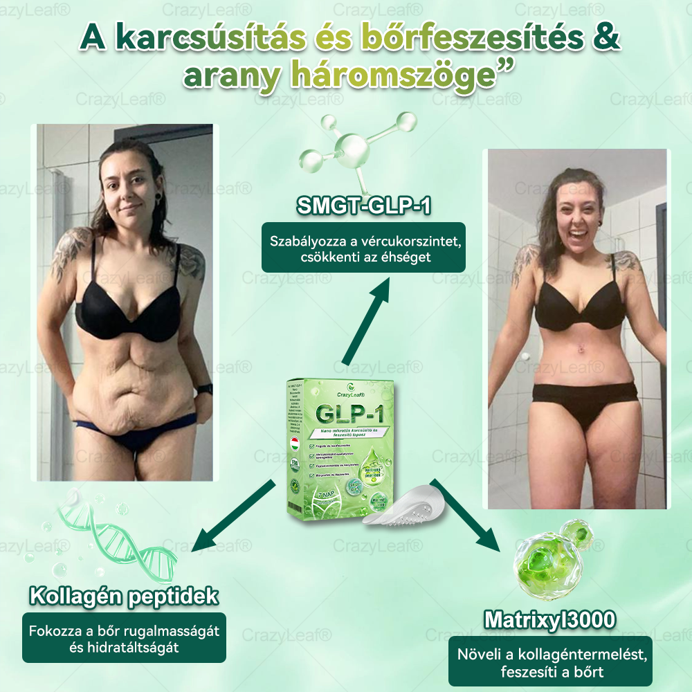 ✅│Hivatalos webáruház│🌿 CrazyLeaf® SMGT-GLP-1 Nano Mikrotűs Tapasz 👉Természetes segítség túlsúly, fáradtság, bőr- és ízületi problémák ellen.