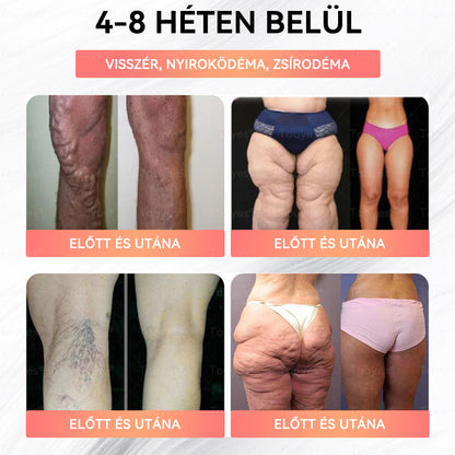 💟Tooyes® GLP-1 Magas Koncentrációjú Folyékony Gyöngyök – NAD+, Moringa, HCA összetevőkkel (Fogyás, Öregedésgátlás, Bél- és Immunrendszer támogatás, Vércukorszint egyensúly, Szív- és Agyegészség) ⚡