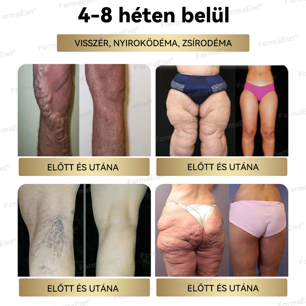 🔥🔥A Mayo Clinic által ajánlott | Hivatalos üzlet | FormaÉlet® GLP-1 Moringa Fogyókúrás és Egészségfokozó cseppek 🌿 (Élelmiszer-minőségű zsírégető – Az Obesity Society fejlesztése)