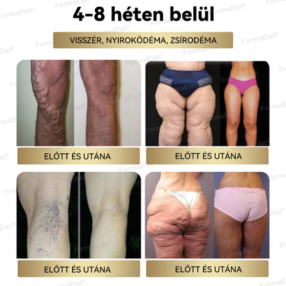 🔥🔥A Mayo Clinic által ajánlott | Hivatalos üzlet | FormaÉlet® GLP-1 Moringa Fogyókúrás és Egészségfokozó cseppek 🌿 (Élelmiszer-minőségű zsírégető – Az Obesity Society fejlesztése)