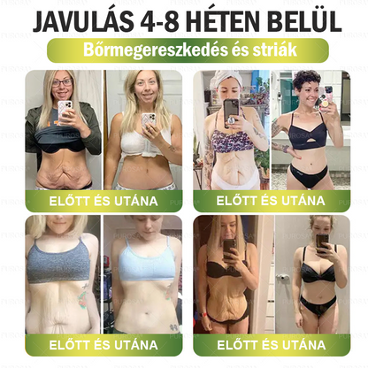 ✅│Hivatalos webáruház│🌿 CrazyLeaf® SMGT-GLP-1 Nano Mikrotűs Tapasz 👉Természetes segítség túlsúly, fáradtság, bőr- és ízületi problémák ellen.