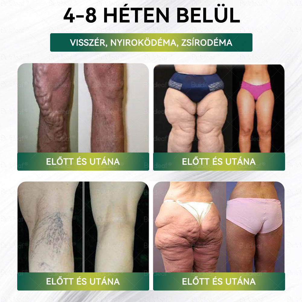 【Hivatalos áruház】🍃🍃Buildleaf® SMGT-GLP-1 Nano Mikrotű Tapasz - Kollagénnel és Matrixyl 3000-rel 丨Célzott hatás: elhízás, megereszkedett bőr, magas vérnyomás, cukorbetegség, zsírmáj, testi fájdalmak és egyéb problémák ellen